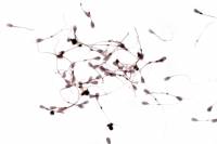 Spermatozoïdes de Taureau x170